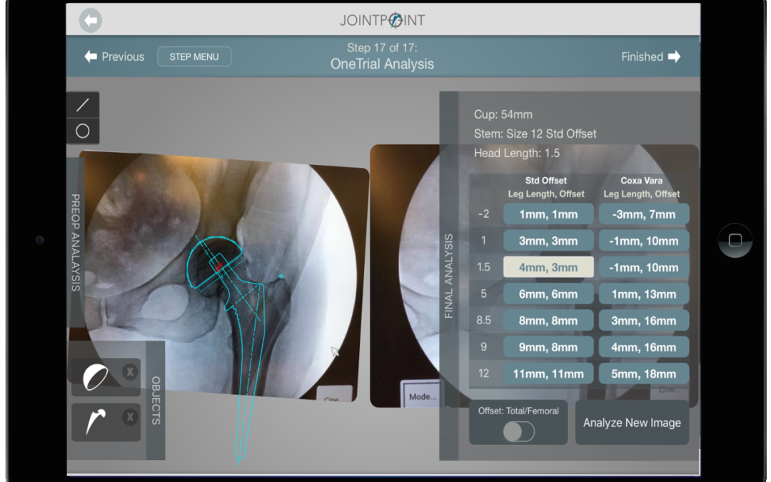 Digital Solutions in Hip Replacement Surgery: From good enough to perfect